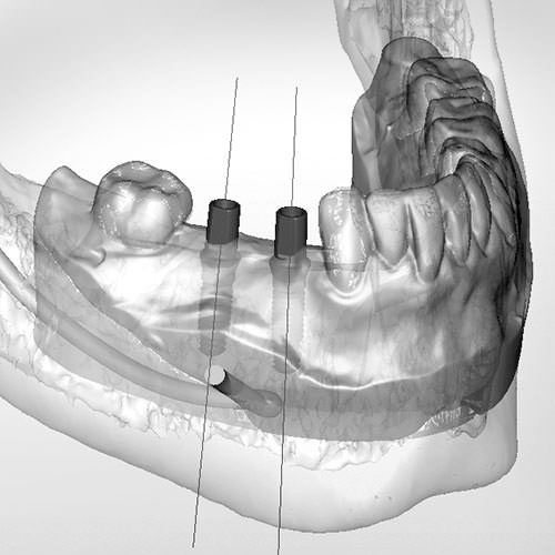 eppers_dentallabor_digital_2 eppers_dentallabor_digital_2